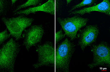 Anti-CNOT8 antibody [HL2586] used in Immunocytochemistry/ Immunofluorescence (ICC/IF). GTX639037