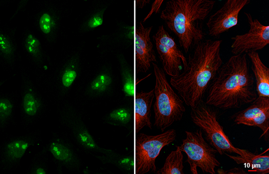 Anti-Fibrillarin + FBLL1 antibody [HL2588] used in Immunocytochemistry/ Immunofluorescence (ICC/IF). GTX639039