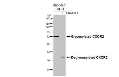 Anti-CXCR2 antibody [HL2604] used in Western Blot (WB). GTX639056