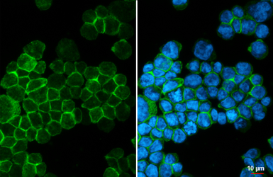 Anti-CXCR2 antibody [HL2604] used in Immunocytochemistry/ Immunofluorescence (ICC/IF). GTX639056