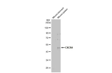 Anti-CXCR4 antibody [HL2612] used in Western Blot (WB). GTX639064