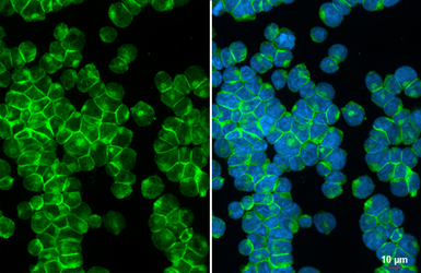 Anti-CXCR4 antibody [HL2612] used in Immunocytochemistry/ Immunofluorescence (ICC/IF). GTX639064