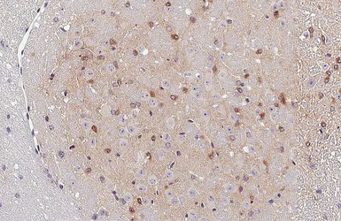 Anti-CXCR4 antibody [HL2612] used in IHC (Paraffin sections) (IHC-P). GTX639064