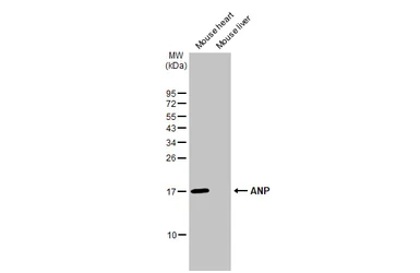 Anti-ANP antibody [HL2617] used in Western Blot (WB). GTX639071