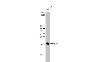 Anti-ANP antibody [HL2617] used in Western Blot (WB). GTX639071