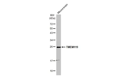 Anti-TMEM119 antibody [HL2627] used in Western Blot (WB). GTX639083