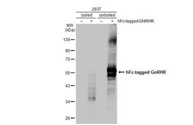 Anti-GnRHR antibody [HL2638] used in Western Blot (WB). GTX639094