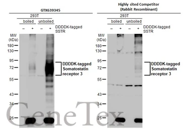 Anti-Somatostatin receptor 3 antibody [HL2681] used in Western Blot (WB). GTX639345