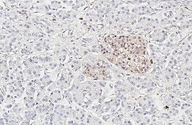 Anti-Somatostatin receptor 3 antibody [HL2681] used in IHC (Paraffin sections) (IHC-P). GTX639345