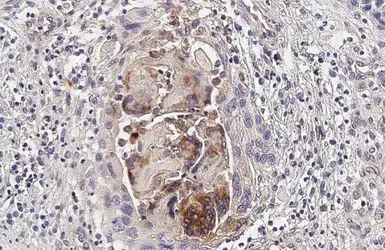 Anti-CHI3L1 antibody [HL2708] used in IHC (Paraffin sections) (IHC-P). GTX639462