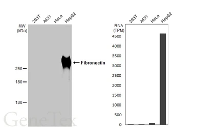 Anti-Fibronectin antibody [HL2761] used in Western Blot (WB). GTX639626