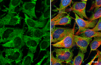 Anti-Fibronectin antibody [HL2761] used in Immunocytochemistry/ Immunofluorescence (ICC/IF). GTX639626