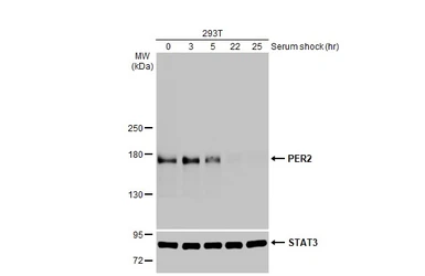 Anti-PER2 antibody [HL2775] used in Western Blot (WB). GTX639640