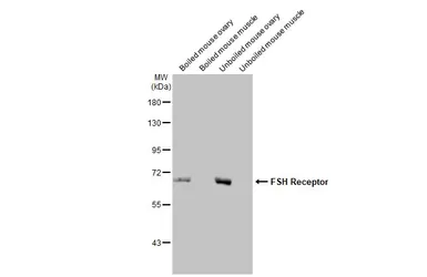 Anti-FSH Receptor antibody [HL2784] used in Western Blot (WB). GTX639652