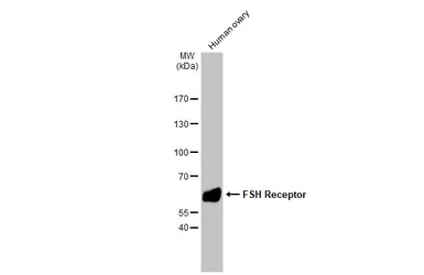Anti-FSH Receptor antibody [HL2784] used in Western Blot (WB). GTX639652