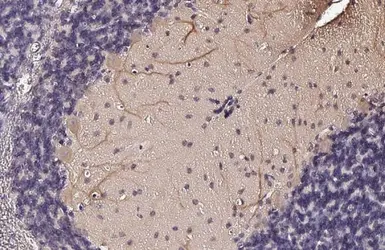 Anti-LC3B antibody [HL2798] used in IHC (Paraffin sections) (IHC-P). GTX639686