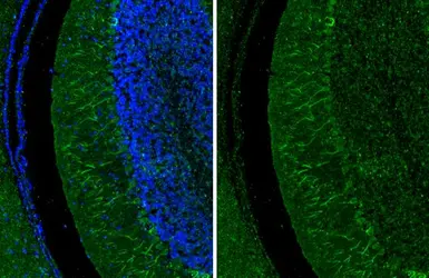 Anti-LC3B antibody [HL2798] used in IHC (Paraffin sections) (IHC-P). GTX639686