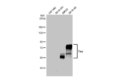 Anti-Tau antibody [HL2802] used in Western Blot (WB). GTX639694