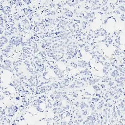 Anti-PD-L1 antibody [H302] HistoMAX&trade; used in IHC (Paraffin sections) (IHC-P). GTX639925