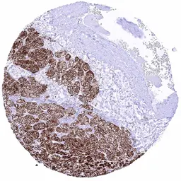 Anti-StAR antibody [HMV306] HistoMAX&trade; used in IHC (Paraffin sections) (IHC-P). GTX639930