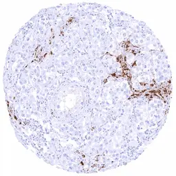 Anti-StAR antibody [HMV306] HistoMAX&trade; used in IHC (Paraffin sections) (IHC-P). GTX639930