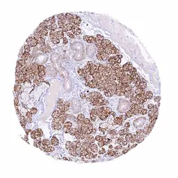 Anti-Claudin 3 antibody [HMV309] HistoMAX&trade; used in IHC (Paraffin sections) (IHC-P). GTX639933