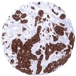 Anti-Claudin 3 antibody [HMV309] HistoMAX&trade; used in IHC (Paraffin sections) (IHC-P). GTX639933