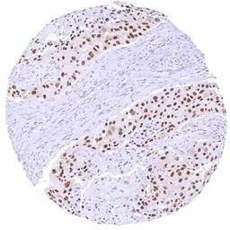 Anti-KDM6A antibody [HMV311] HistoMAX&trade; used in IHC (Paraffin sections) (IHC-P). GTX639935