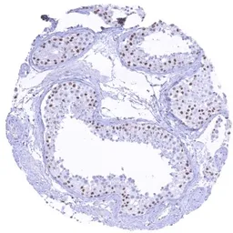 Anti-KDM6A antibody [HMV311] HistoMAX&trade; used in IHC (Paraffin sections) (IHC-P). GTX639935