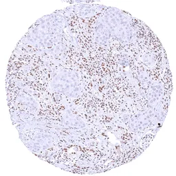Anti-KDM6A antibody [HMV311] HistoMAX&trade; used in IHC (Paraffin sections) (IHC-P). GTX639935