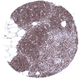 Anti-KDM6A antibody [HMV311] HistoMAX&trade; used in IHC (Paraffin sections) (IHC-P). GTX639935