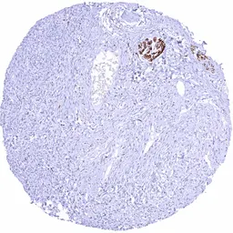 Anti-Tyrosine Hydroxylase antibody [HMV312] HistoMAX&trade; used in IHC (Paraffin sections) (IHC-P). GTX639936