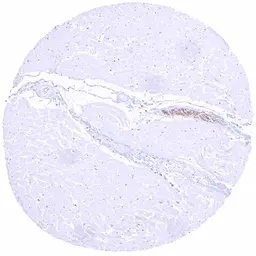 Anti-Tyrosine Hydroxylase antibody [HMV312] HistoMAX&trade; used in IHC (Paraffin sections) (IHC-P). GTX639936