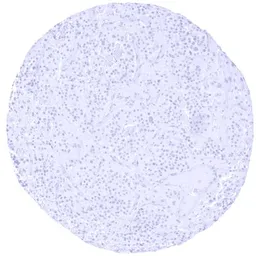 Anti-Tyrosine Hydroxylase antibody [HMV312] HistoMAX&trade; used in IHC (Paraffin sections) (IHC-P). GTX639936