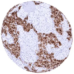Anti-Tyrosine Hydroxylase antibody [HMV312] HistoMAX&trade; used in IHC (Paraffin sections) (IHC-P). GTX639936