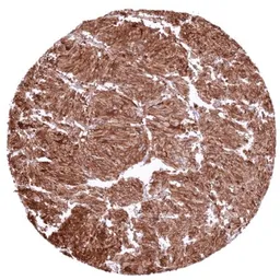 Anti-Tyrosine Hydroxylase antibody [HMV312] HistoMAX&trade; used in IHC (Paraffin sections) (IHC-P). GTX639936