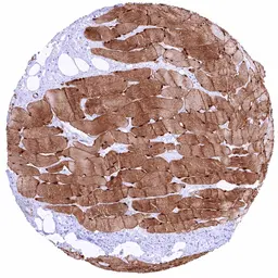 Anti-TRIM72 antibody [HMV313] HistoMAX&trade; used in IHC (Paraffin sections) (IHC-P). GTX639937
