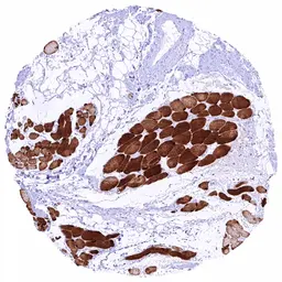 Anti-TRIM72 antibody [HMV313] HistoMAX&trade; used in IHC (Paraffin sections) (IHC-P). GTX639937
