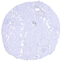 Anti-TRIM72 antibody [HMV313] HistoMAX&trade; used in IHC (Paraffin sections) (IHC-P). GTX639937