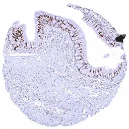 Anti-HMGA2 antibody [HMV314] HistoMAX&trade; used in IHC (Paraffin sections) (IHC-P). GTX639938