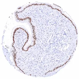 Anti-HMGA2 antibody [HMV314] HistoMAX&trade; used in IHC (Paraffin sections) (IHC-P). GTX639938