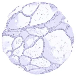 Anti-HMGA2 antibody [HMV314] HistoMAX&trade; used in IHC (Paraffin sections) (IHC-P). GTX639938