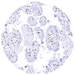Anti-HMGA2 antibody [HMV314] HistoMAX&trade; used in IHC (Paraffin sections) (IHC-P). GTX639938