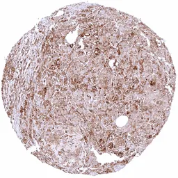 Anti-MX1 antibody [HMV316] HistoMAX&trade; used in IHC (Paraffin sections) (IHC-P). GTX639940