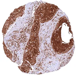 Anti-MX1 antibody [HMV316] HistoMAX&trade; used in IHC (Paraffin sections) (IHC-P). GTX639940