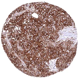 Anti-MX1 antibody [HMV316] HistoMAX&trade; used in IHC (Paraffin sections) (IHC-P). GTX639940
