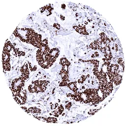 Anti-HMGB1 antibody [HMV317] HistoMAX&trade; used in IHC (Paraffin sections) (IHC-P). GTX639941