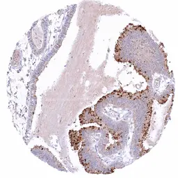 Anti-Pepsinogen I antibody [HMV318] HistoMAX&trade; used in IHC (Paraffin sections) (IHC-P). GTX639942