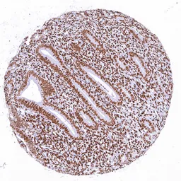 Anti-CBP antibody [HMV319] HistoMAX&trade; used in IHC (Paraffin sections) (IHC-P). GTX639943