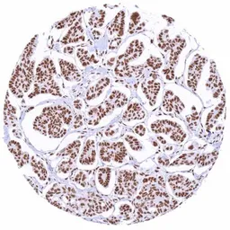 Anti-CBP antibody [HMV319] HistoMAX&trade; used in IHC (Paraffin sections) (IHC-P). GTX639943